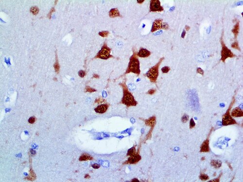 IHC of NeuN on an FFPE Brain Tissue
